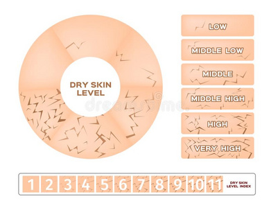 干的干燥的皮水平信息图