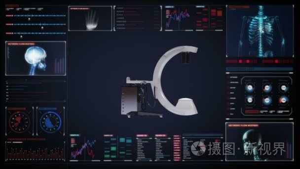 C 臂 x 光机扫描数字显示仪表板，医疗诊断技术中视频