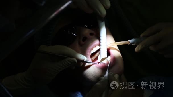 牙医治疗牙齿的女孩视频