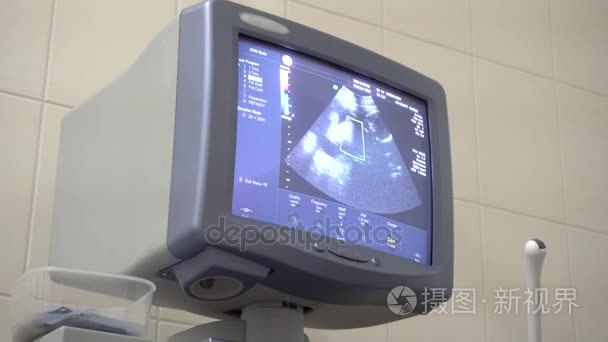 女性子宫图像监测超声检查设备。门诊病人的诊断