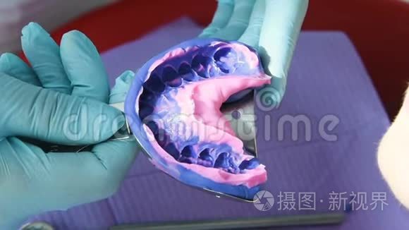 牙医为修复术铸造牙齿视频