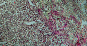 显微镜下的大型肠道大肠31秒视频