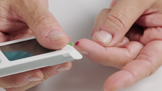 从手指取血到测定血糖的试纸的过程男人的手握着带显示器视频