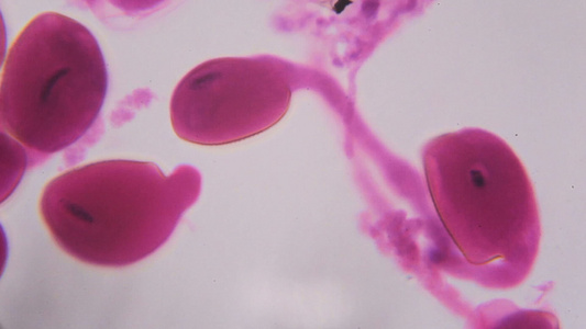 在显微镜下白底的抽象粉红色圆点成熟了缩微镜视频