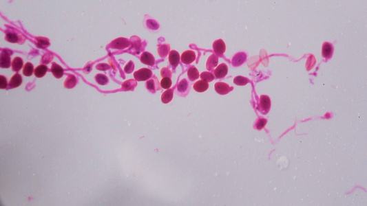 在显微镜下白底的抽象粉红色圆点成熟了缩微镜视频