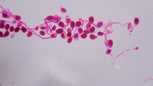 在显微镜下白底的抽象粉红色圆点成熟了缩微镜12秒视频