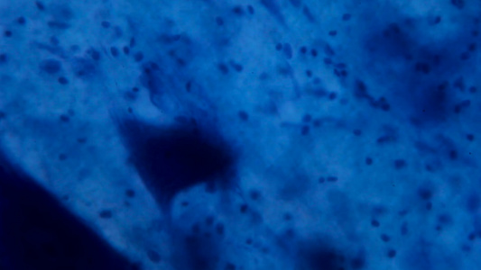 显微镜下的神经元细胞白色背景上的抽象蓝色点视频