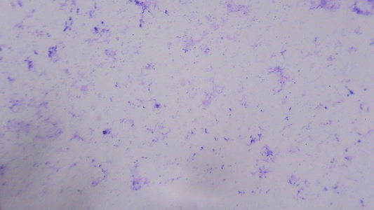 显微镜下的神经元细胞白色背景上的抽象蓝色点视频