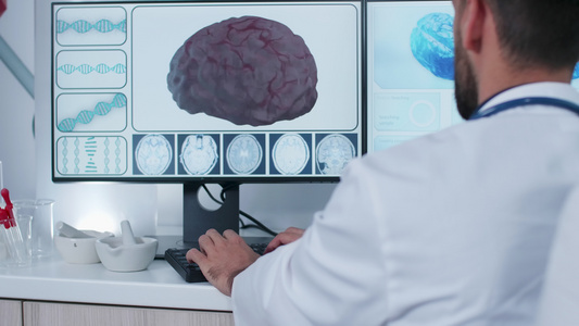 3D脑扫描前的医生手持枪视频
