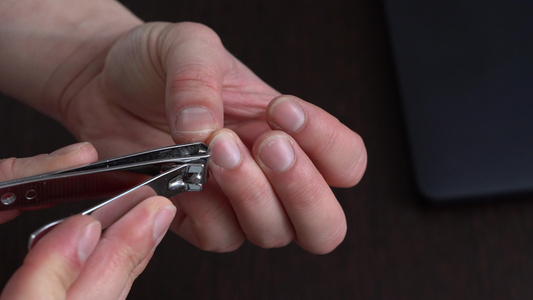 个人卫生用tweezers剪指甲视频