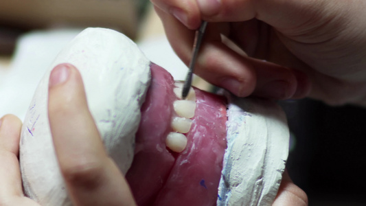 牙齿假牙模型牙医工作视频