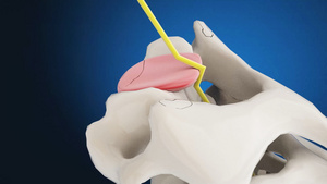 3d腰间盘突出动画8秒视频