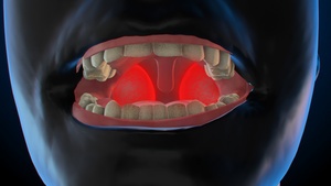 3D人体医疗扁桃体发炎15秒视频