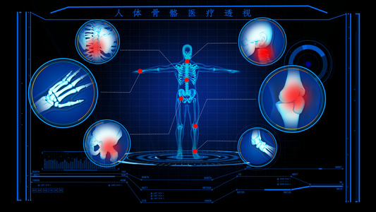 4Ｋ人体骨骼病症演示模板视频