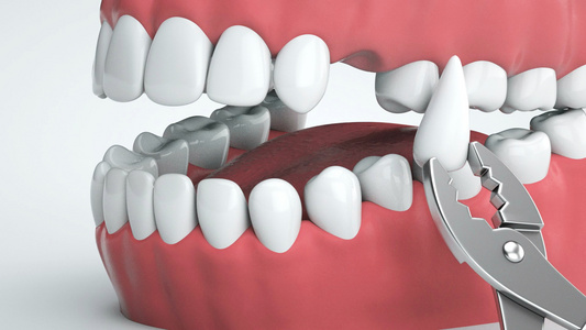 3d医疗牙齿修复治疗动画视频