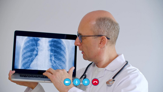在视频聊天期间使用带有肺部X射线图像的医生视频