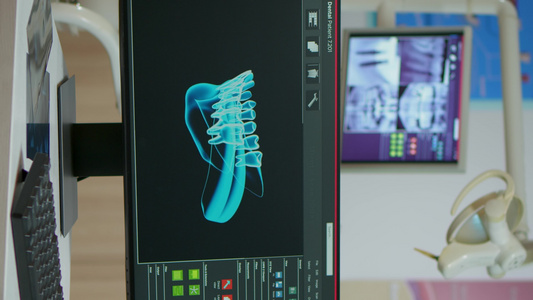 垂直视频空牙科医疗室电脑上数字X光片视频
