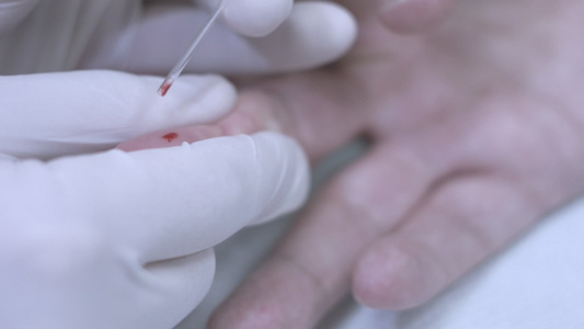 用手指抽血手指血液测试样本手指抽血[测血]视频