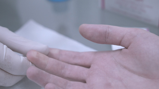用手指穿刺验血采集血样医用针头注射视频