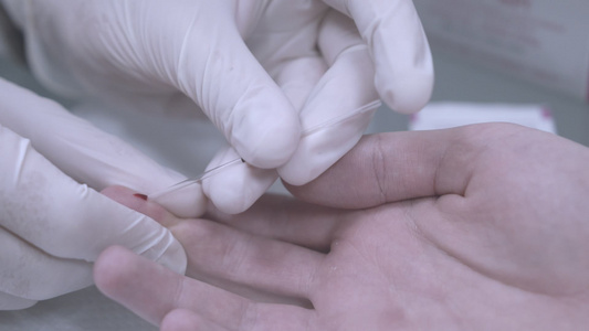 手指验血手戴手套采集血样的特写镜头医学检验视频
