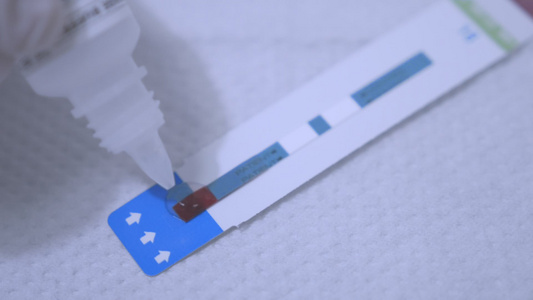 将试剂滴在测试条上血液hiv检测试纸Hiv血液检测视频
