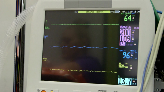 在救护车多参数病人监测器屏幕视频