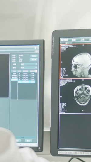 实拍电脑屏幕医疗检查结果核磁共振16秒视频