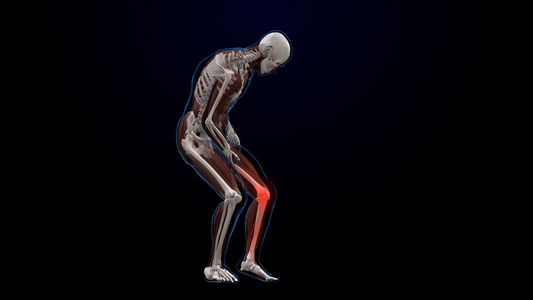 膝盖疼痛医疗人体解析视频