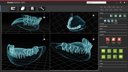 人体X光牙和扫描软件接口视频
