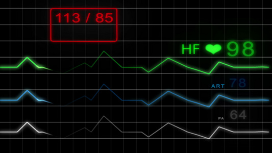 ECG监护仪带脉冲带网格高清视频