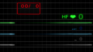 eccg如带网格的无脉冲监视器hd20秒视频