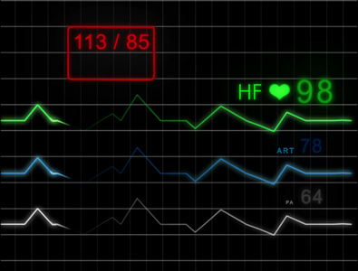 ECG监护仪带脉冲带网格4K视频