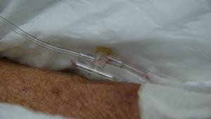 住院病人的盐碱静脉注射11秒视频