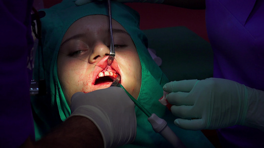 口腔外科手术用夹紧的缝合器把伤口缝上视频