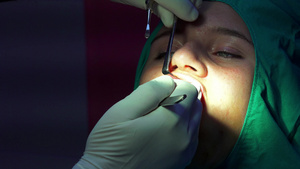 牙科植牙手术显像性口香糖手术闭合30秒视频