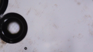 显微镜下的水泡12秒视频