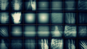 x射线图片背景16秒视频