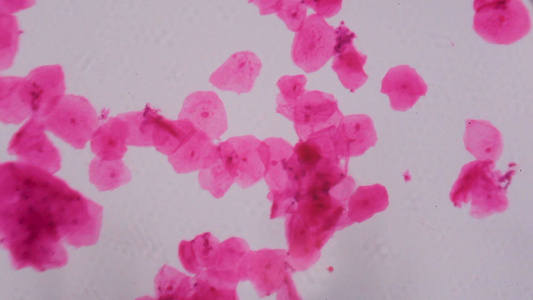 显微镜下的多孔相上皮白色背景上的抽象粉色点视频
