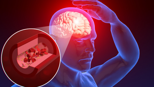 3D人体医疗脑部出血视频