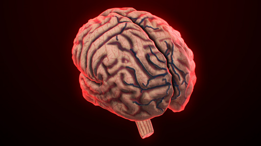 3D人体医疗脑萎缩视频