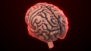 3D人体医疗脑萎缩15秒视频