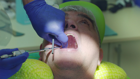 检查牙齿过程视频
