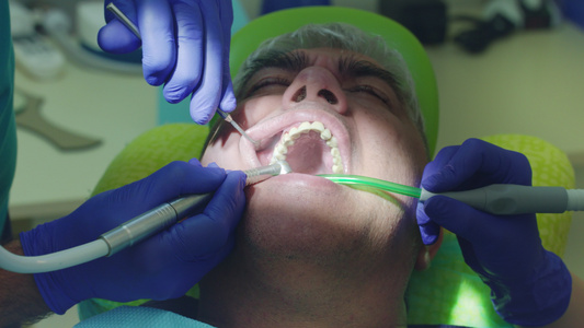 在牙医科治疗男性病人的牙科医生视频