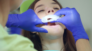 牙医帮助病人戴上牙套25秒视频