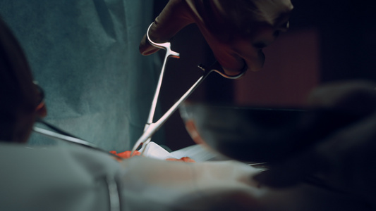 特写外科医生手在医院手术室用镊子缝合伤口视频