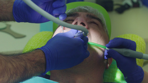 牙医手术过程15秒视频