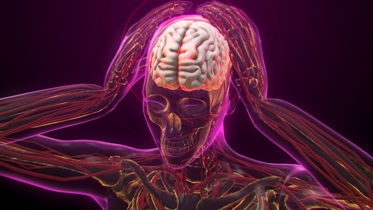 3D人体医疗脑梗阻视频