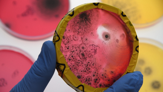 科学家用生物危害胶带检查培养皿中的微生物培养物视频