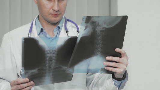 一名医生检查病人X射线扫描的X光视频