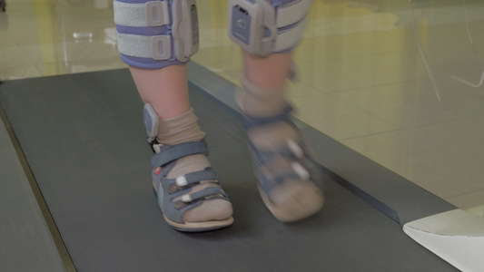 在特殊的整形绷带和脚穿时在运动车上近近视小男孩脚视频